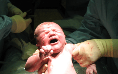 What happens during a C-section?